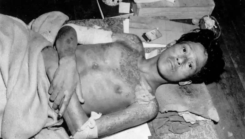 80 Yıl Sonra Nagasaki'den Uyarı: Nükleer Tehdit Yeniden Kapıda