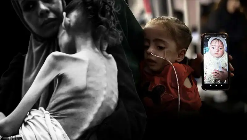 Küçük Meryem’in Dramı: 25 Kilodan 10 Kiloya Düşen Minik Hayat